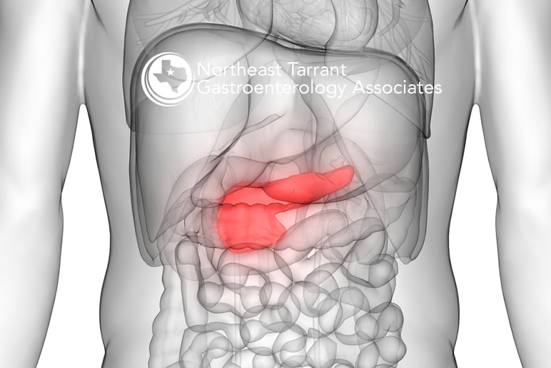 Pancreatic Cancer